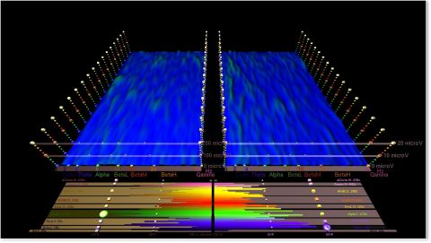 Hipnoterapi otak sangat rileks dan fokus